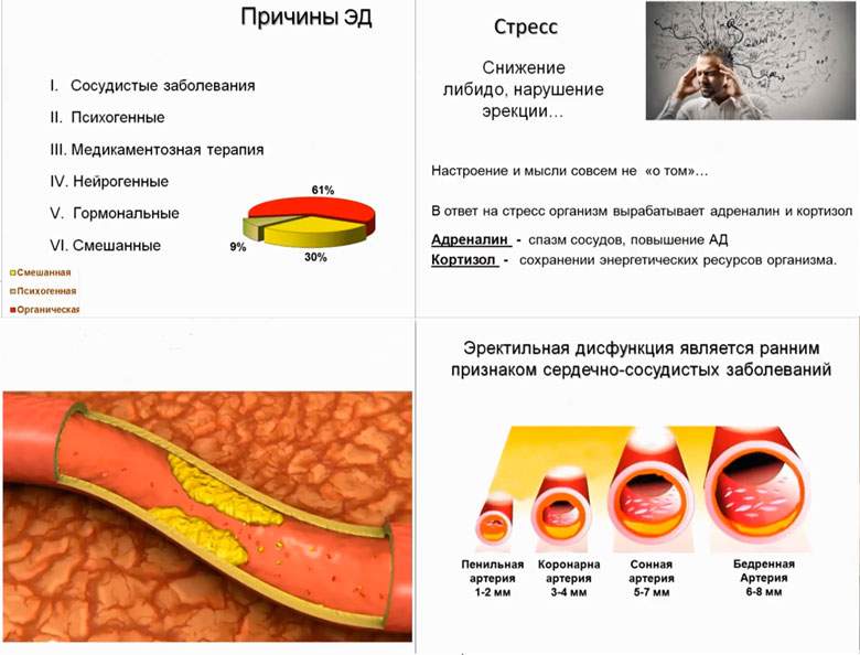 таблетки для улучшения эрекции